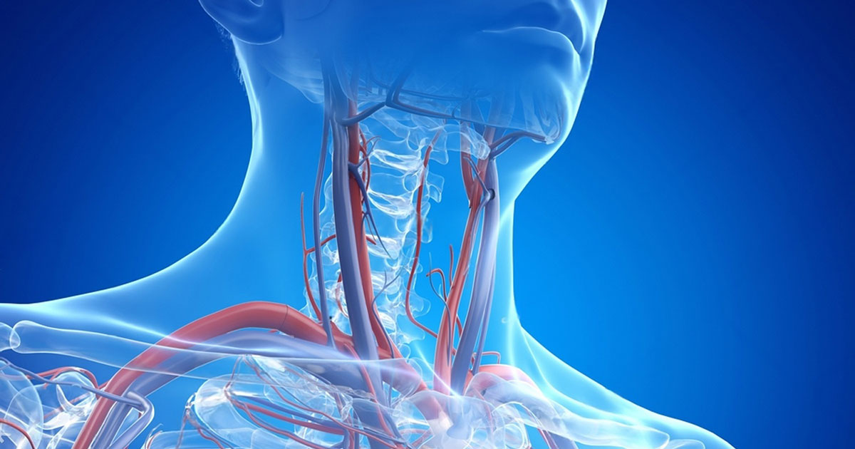 CCSVI et flux veineux